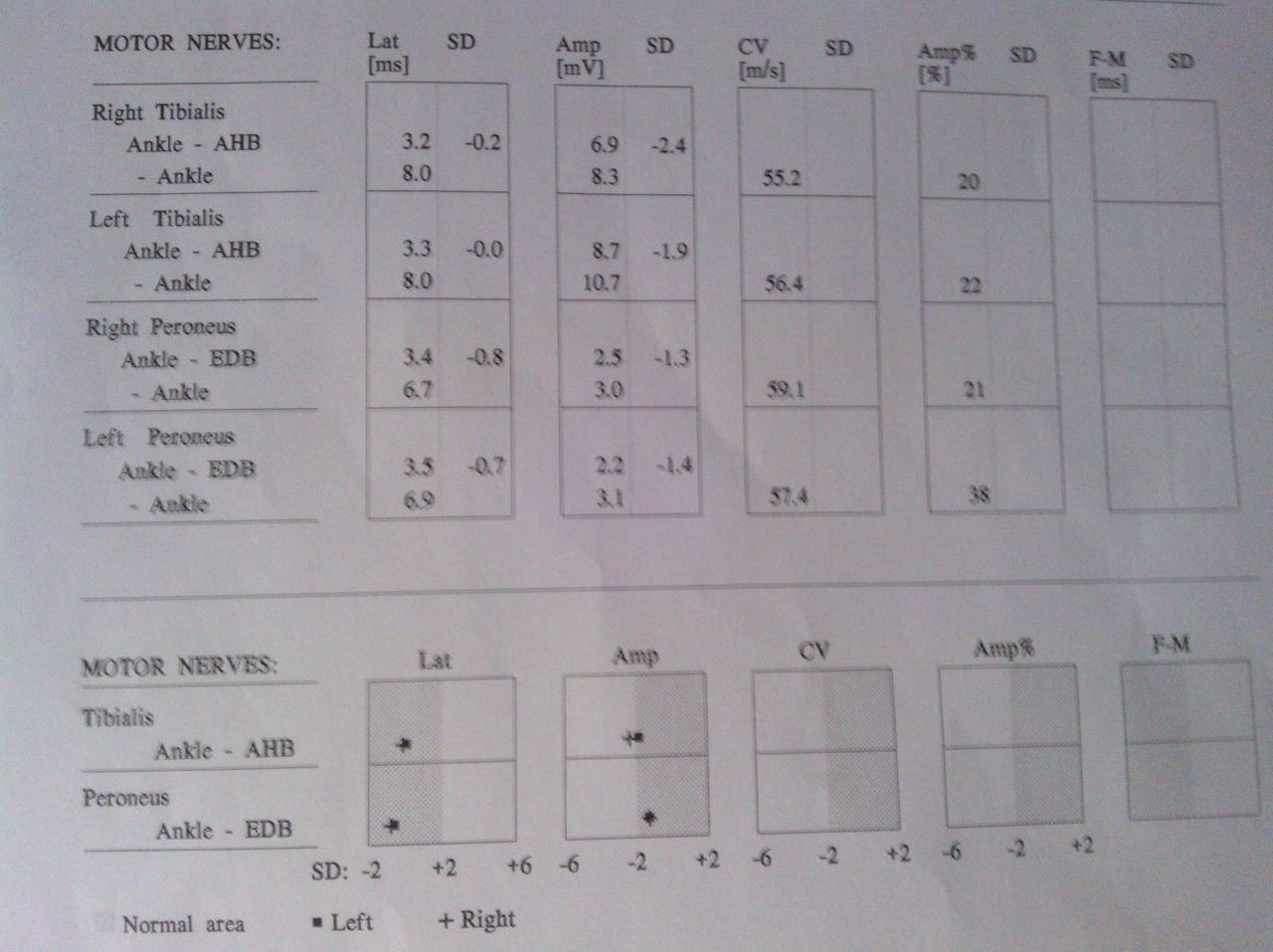  p>肌电图(electromyogram,emg)是指用肌电仪记录下来的肌肉生物电