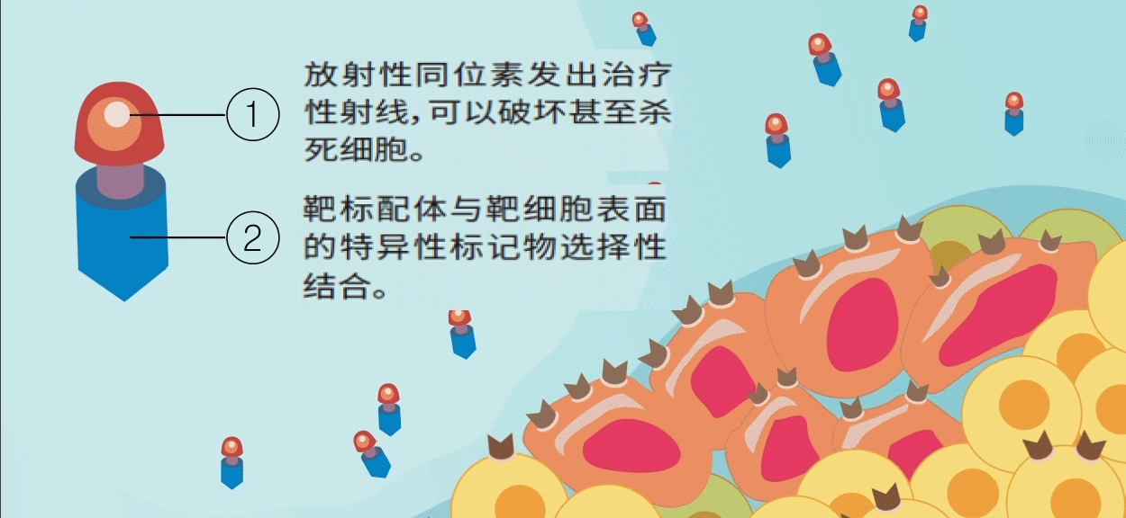 放射配体疗法_百度百科