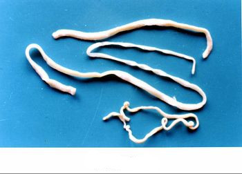 舌状绦虫的<a href="#" data