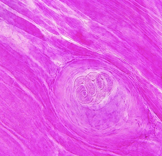  p>猪 a>旋毛虫病 /a>(trichinella spiralis)是由 a href="#" data