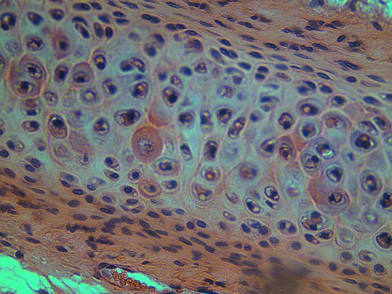  p>透明软骨(hyaline cartilage)分布较广,成体的 a href="#" data