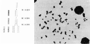 畸变(chromosomal aberration)是指生物细胞中染色体在数目和结构上