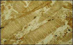 其特征是岩石中含有高岭石重结晶形成的蠕虫状晶体