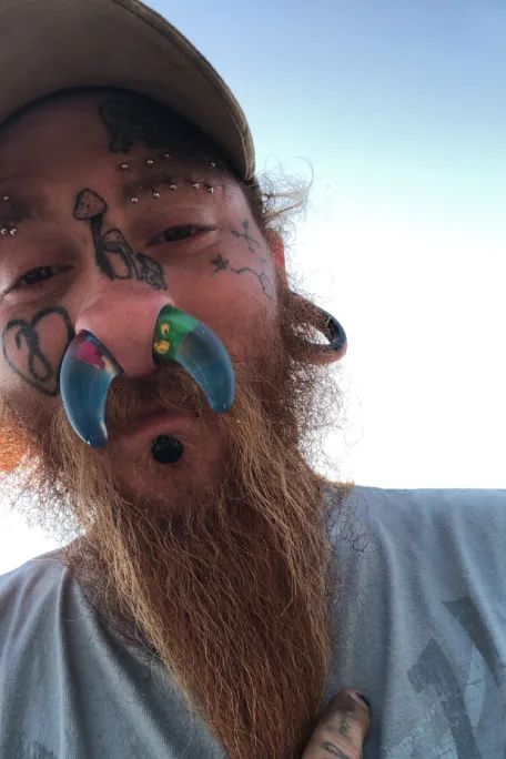 6 厘米,打破了最大鼻中隔穿孔