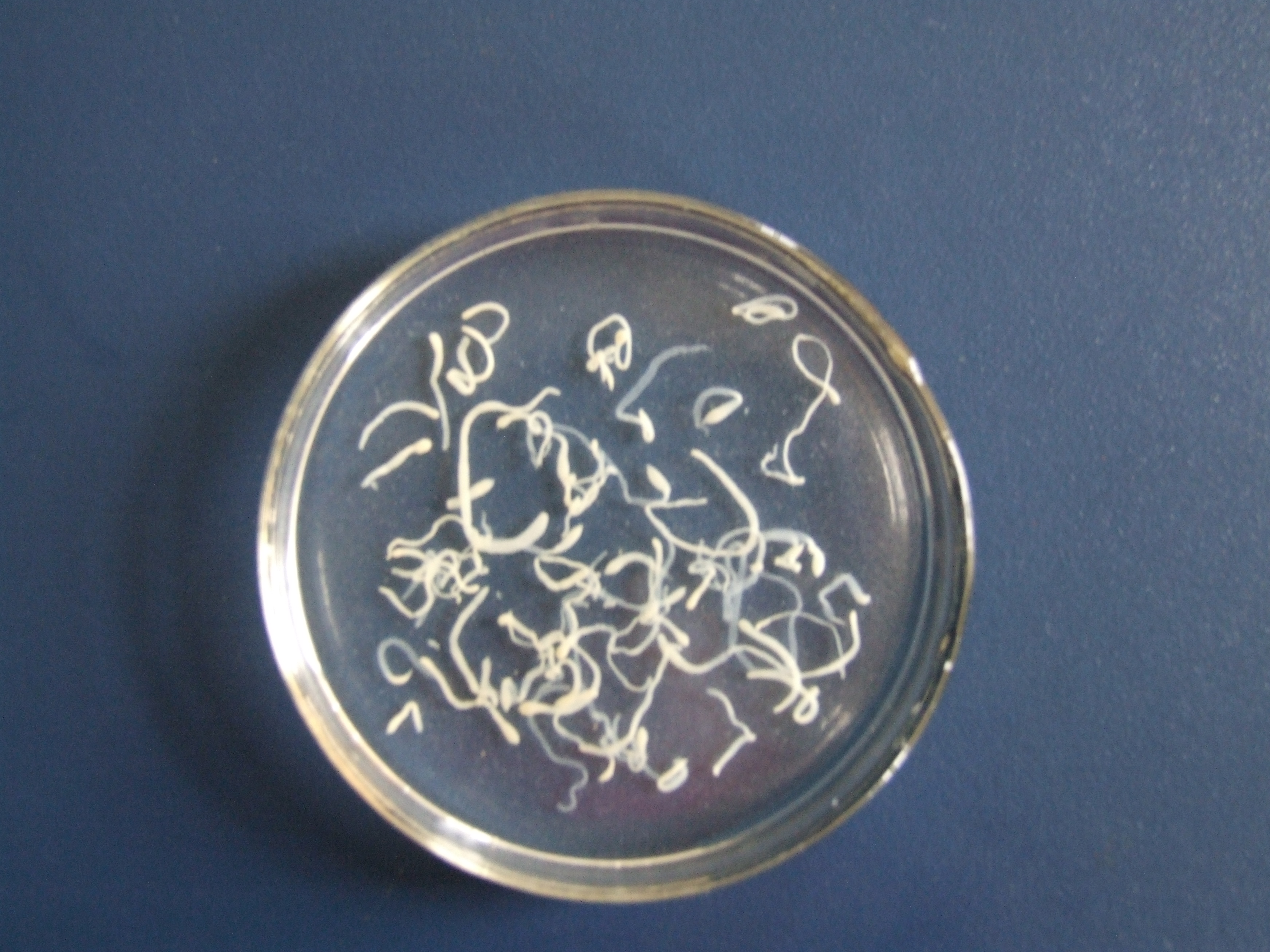  p>棘球绦  即  a target="_blank" href="/item/绦虫/873434" data