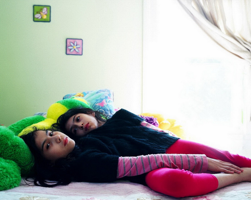 墨西哥连体姐妹