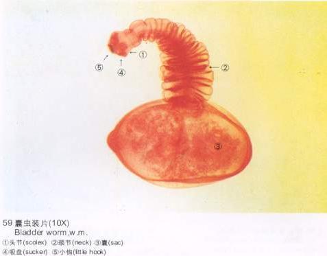  p data-id="gnwh9dotvh">是猪 a target="_blank" href="/item/绦虫"