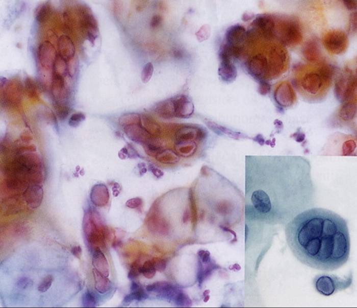 螨虫属于<a href="#" data