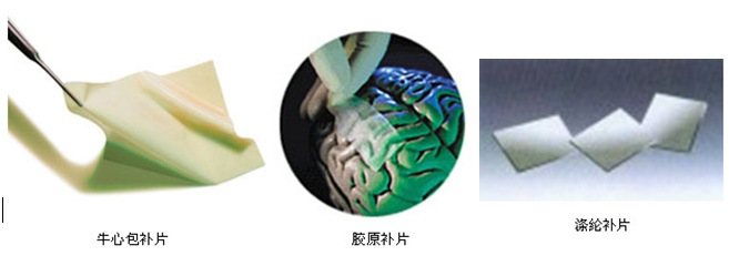 人工硬脑膜