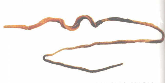 saccoglossus hwangtauensis