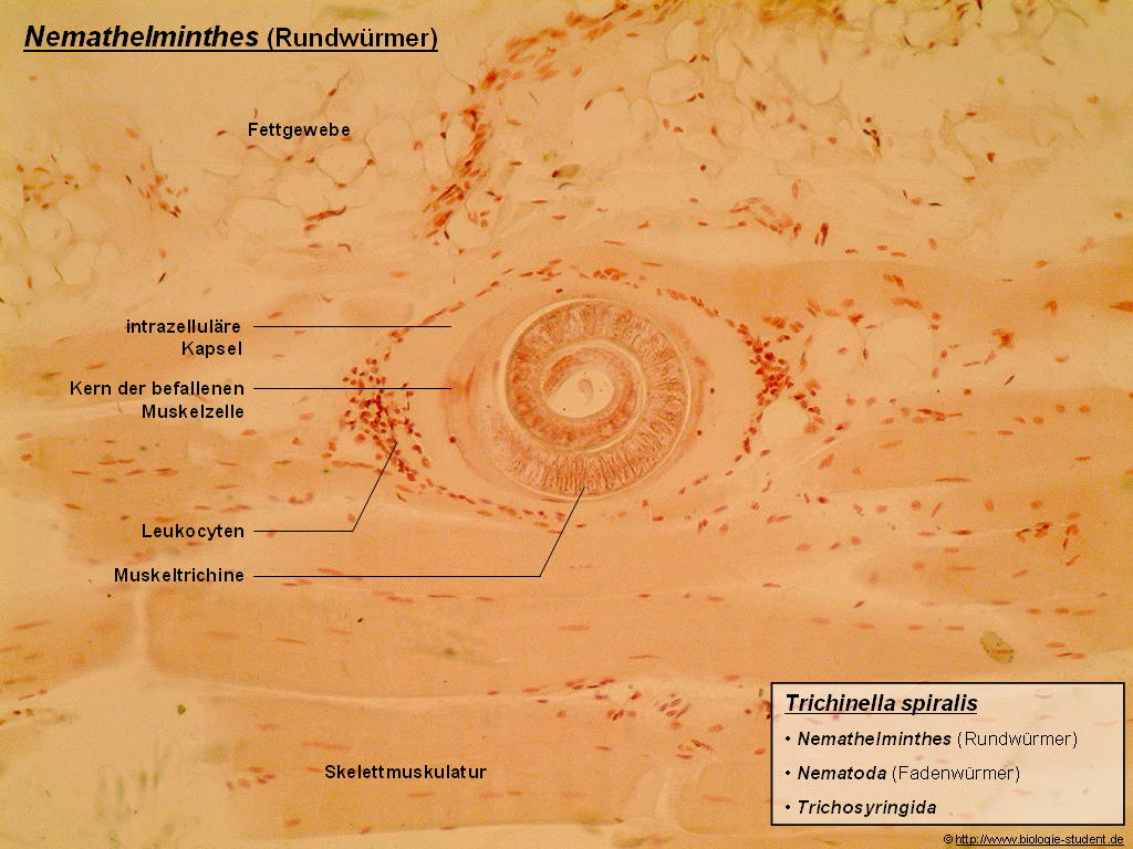  p>旋毛虫 a target="_blank" href="/item/幼虫寄生/2697752" data