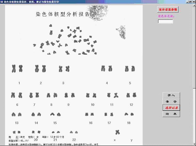 染色体分析系统