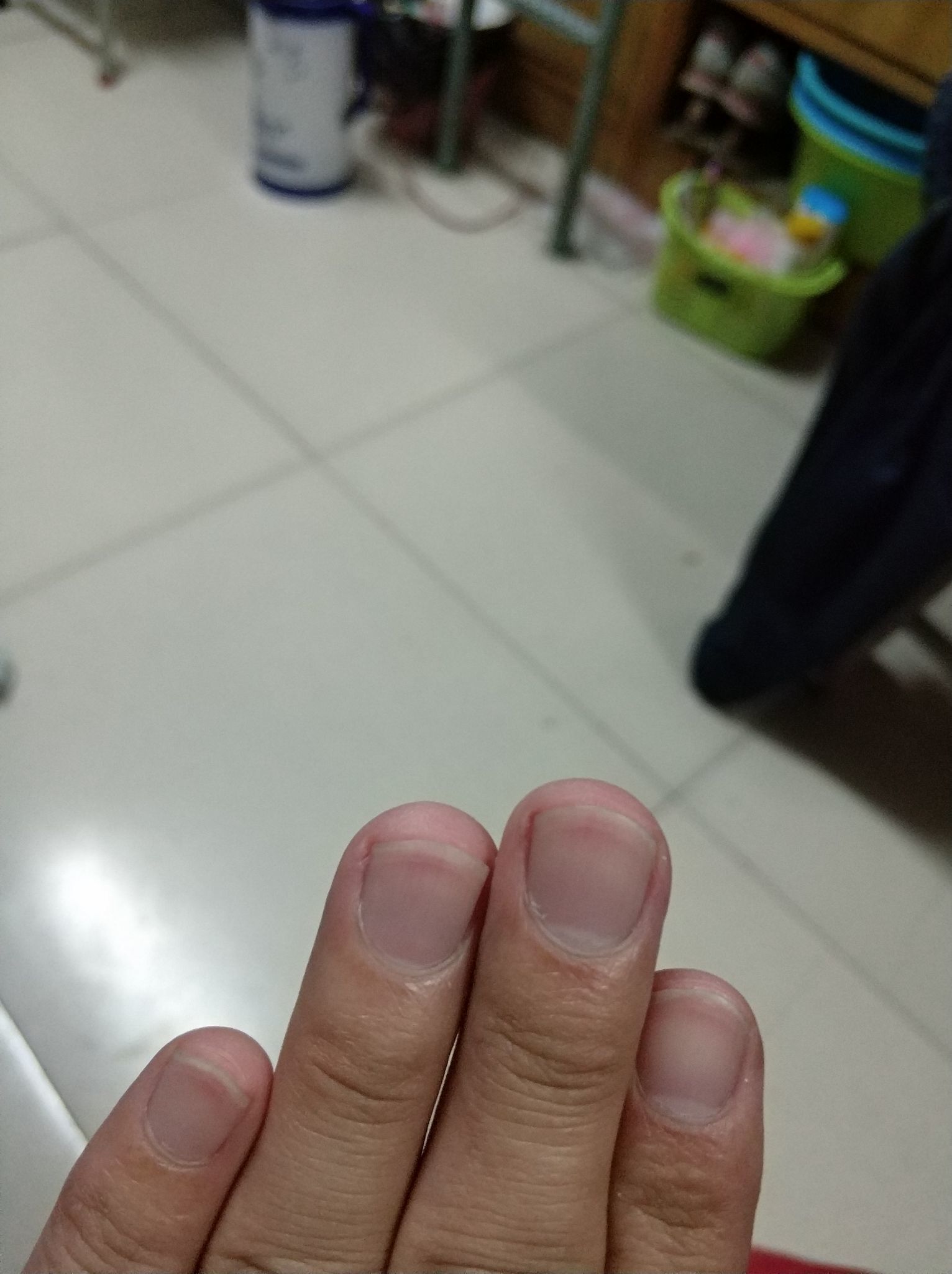  p>肉刺俗称倒裂刺,是甲皱襞近端或侧方的表皮被撕裂而成 a target="