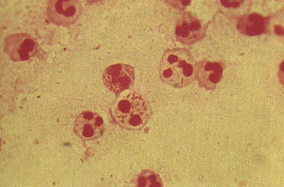 lemmaid="2259772">无菌性前列腺炎 /a>,其发病原因主要包括衣原体