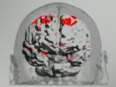失歌症_百度百科