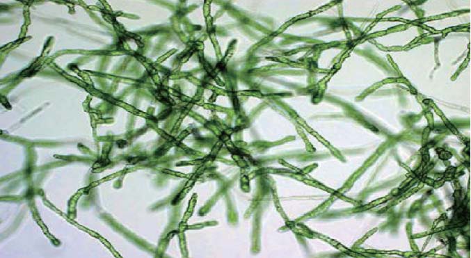 physcomitrella patens