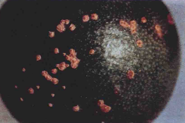 柑桔溃疡病是由地毯黄单胞杆菌引起的,发生在<a href="#" data