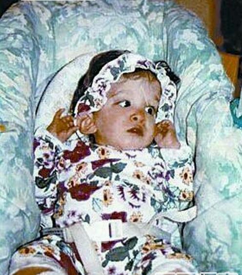 yr">布鲁克·格林伯格,被称为是美国马里兰州巴尔的摩市的"不老女婴"