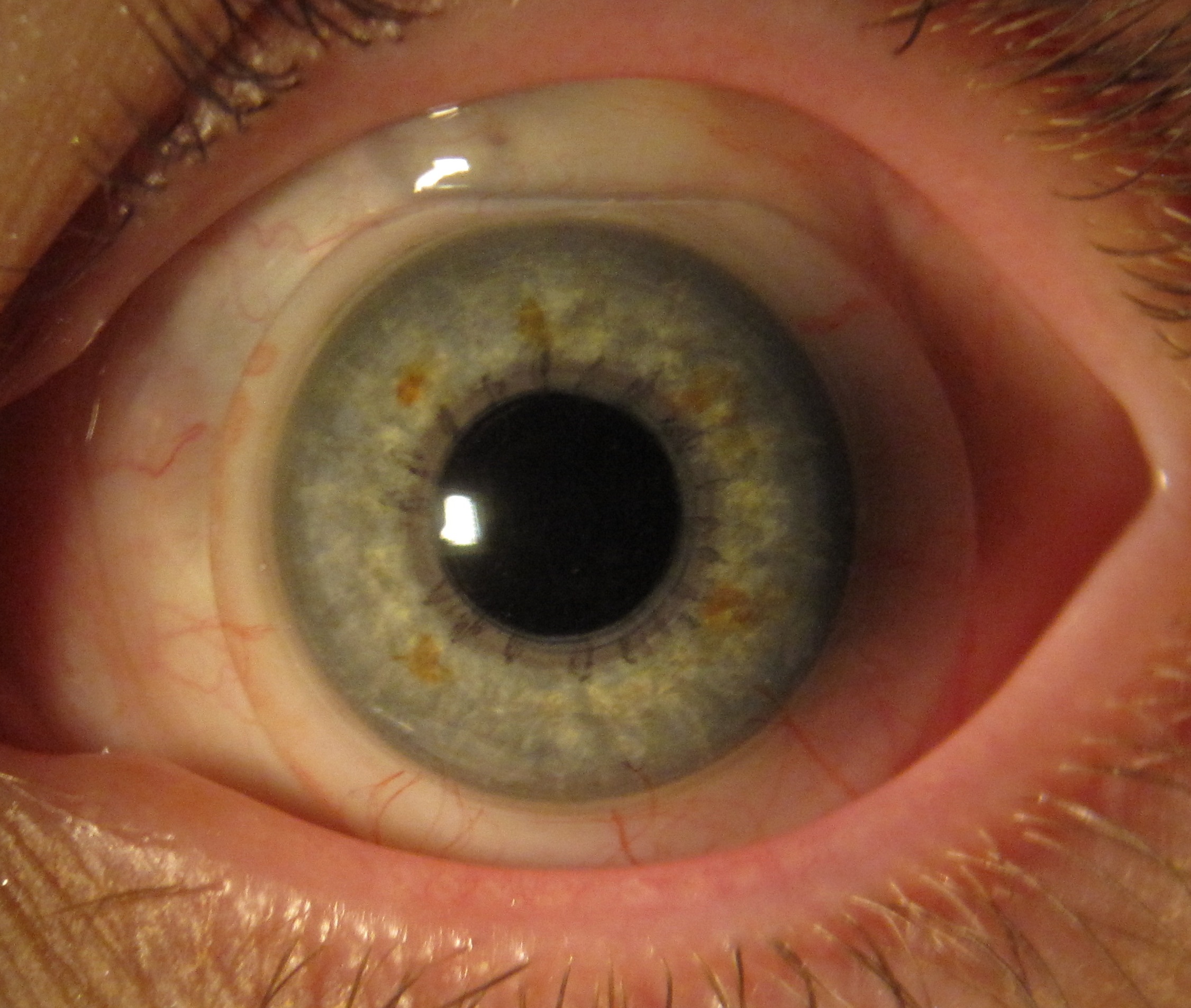  p>眼球壁的主要组成之一.是眼球纤维膜的后5/6部分.