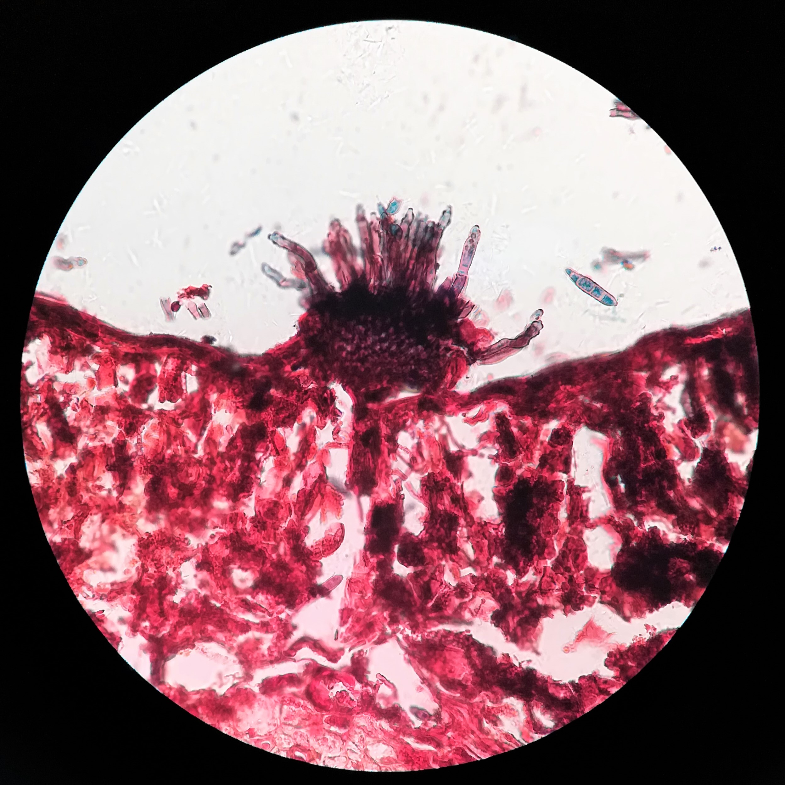 子实体是真菌(多是高等真菌)在生殖时期,形成一定形状和结构,能产生