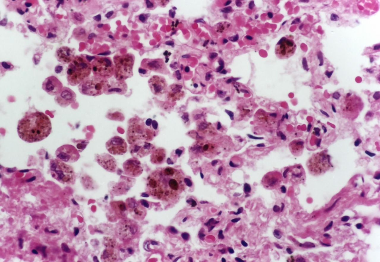  p>淤血是一种常见疾病,指的是因 a href="#">静脉 /a>血液 a href="