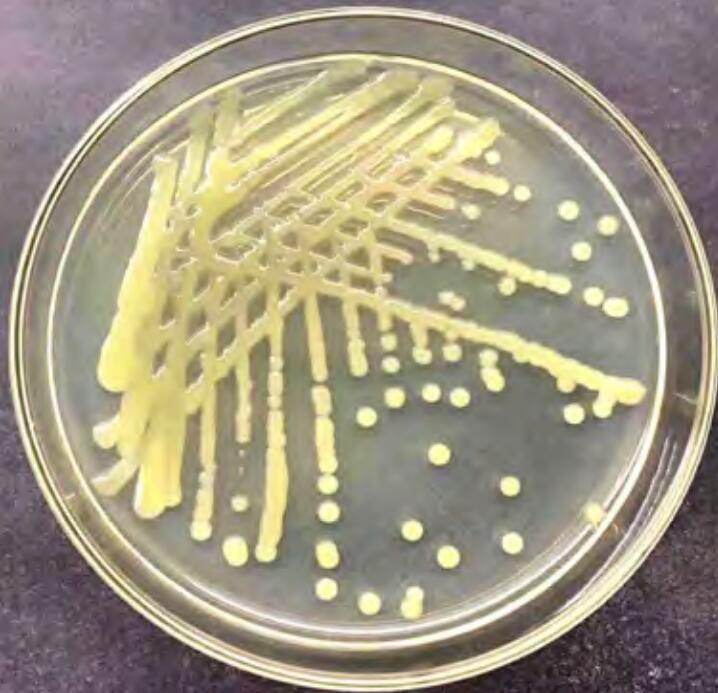  p data-id="suz1dyugrwfe">柠檬溃疡病是由野油菜黄单孢菌柑橘致病