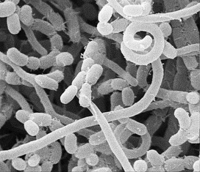  p>放线菌属(actinomyces) 为 a href="#" data-lemmaid="3446154">原