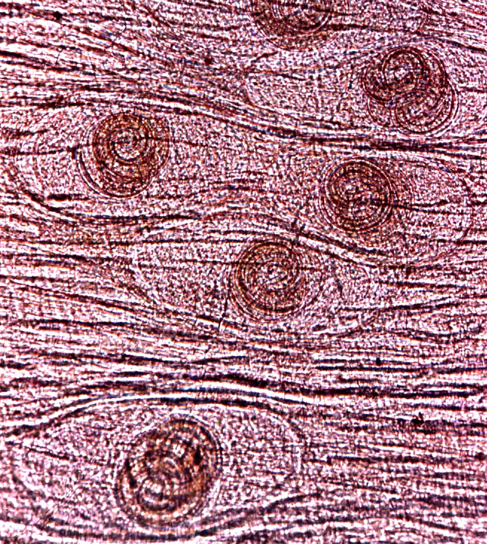  p>旋毛虫 a href="#" data-lemmaid="2697752">幼虫寄生 /a>于肌纤维