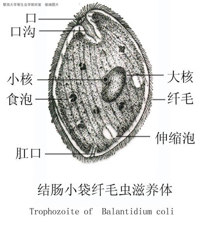 结肠小袋纤毛虫病
