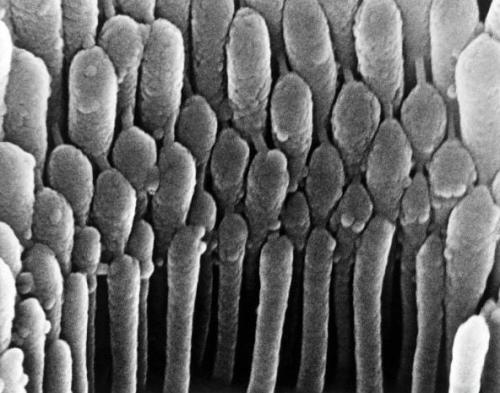 主要功能是自身排布在内耳蜗骨管 a target="_blank" href="/item