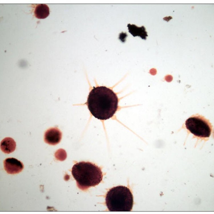  p>子囊菌亚门(ascomycotina) 真菌门中最大的一亚门.