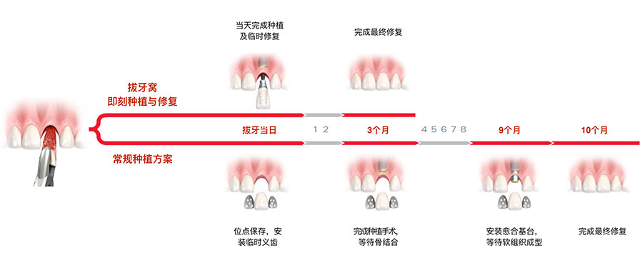  p>诺保科nobel biocare是诺贝尔拜奥凯服务股份公司旗下品牌,又称