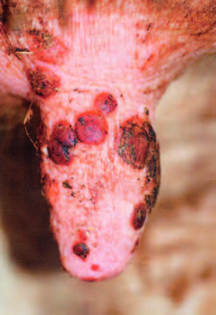  p>伪牛痘(pseudo cowpox)是由副痘病毒引起的感染母牛乳房和乳头的