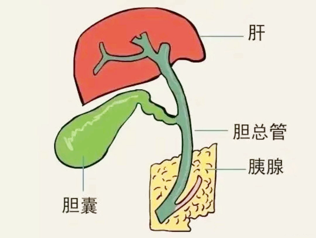 胆囊管综合症