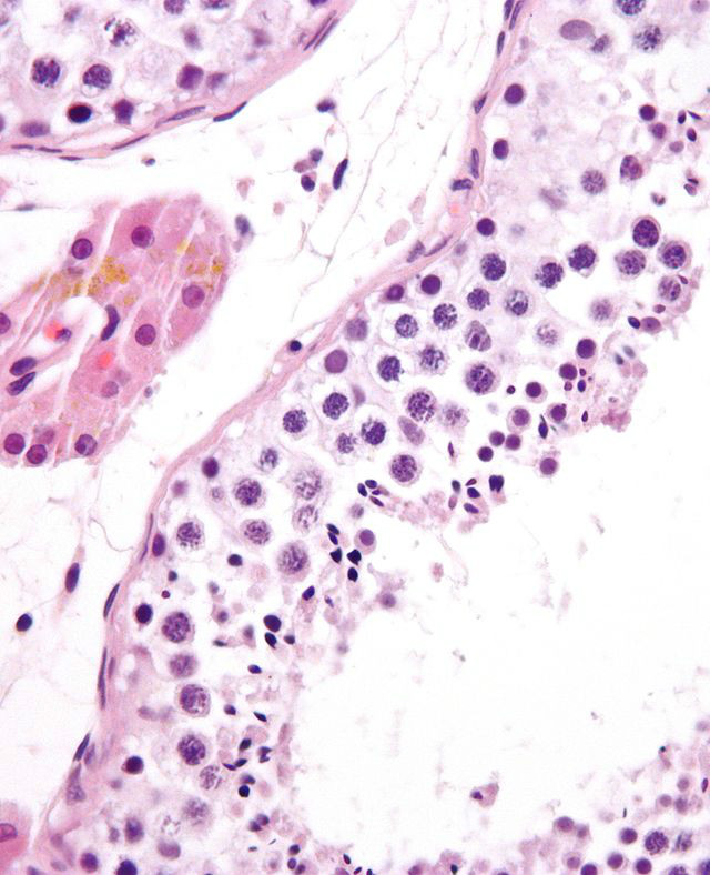  p>精子在睾丸的曲细精管( seminiferous tubules )中产生.