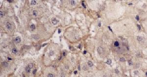  p>肝穿刺就是肝脏组织 a href="#" data-lemmaid="10877419">活检 /a