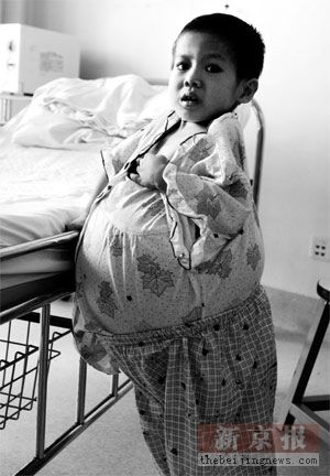  p>李龙,男,1962年5月生,中共党员,小儿外科专家,主任医师,教授,博士