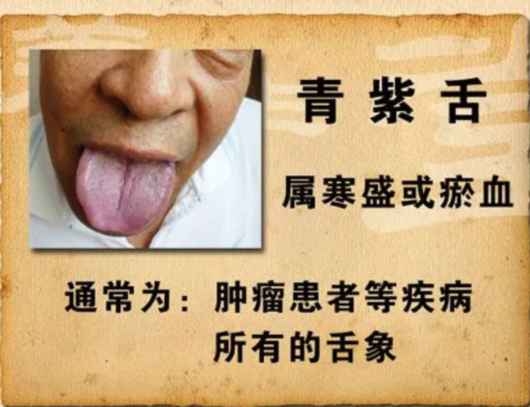 青紫舌