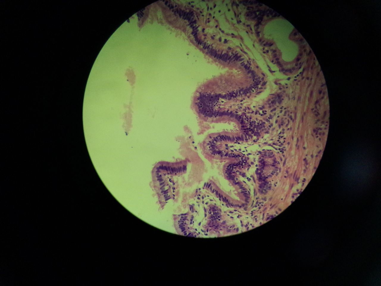  p>单层柱状上皮由一层棱柱形细胞组成.