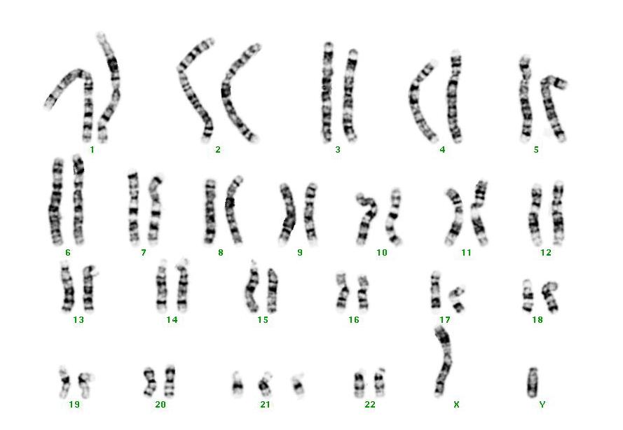  p>1号染色体如同其他的体染色体,一般人类身体内的细胞中,会有两条1