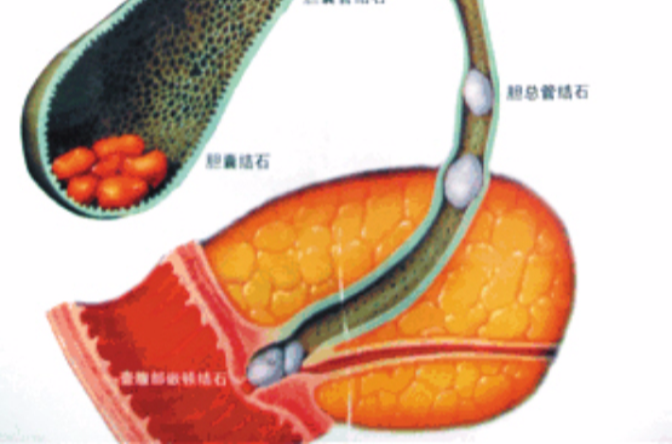 十二指肠大乳头