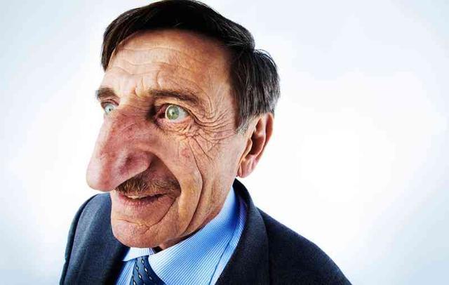 8cm长的鼻子,是当之无愧的"长有世界上最大鼻子之人". /p>