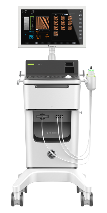 FibroScan_百度百科