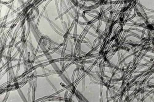  p data-id="gnbt341qff"> a target="_blank" href="/item/碳纳米管