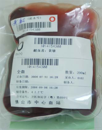  p>红细胞悬液是用三联袋采集全血,经离心移去大部分血浆后,加入 a