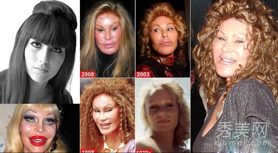 jocelyn wildenstein