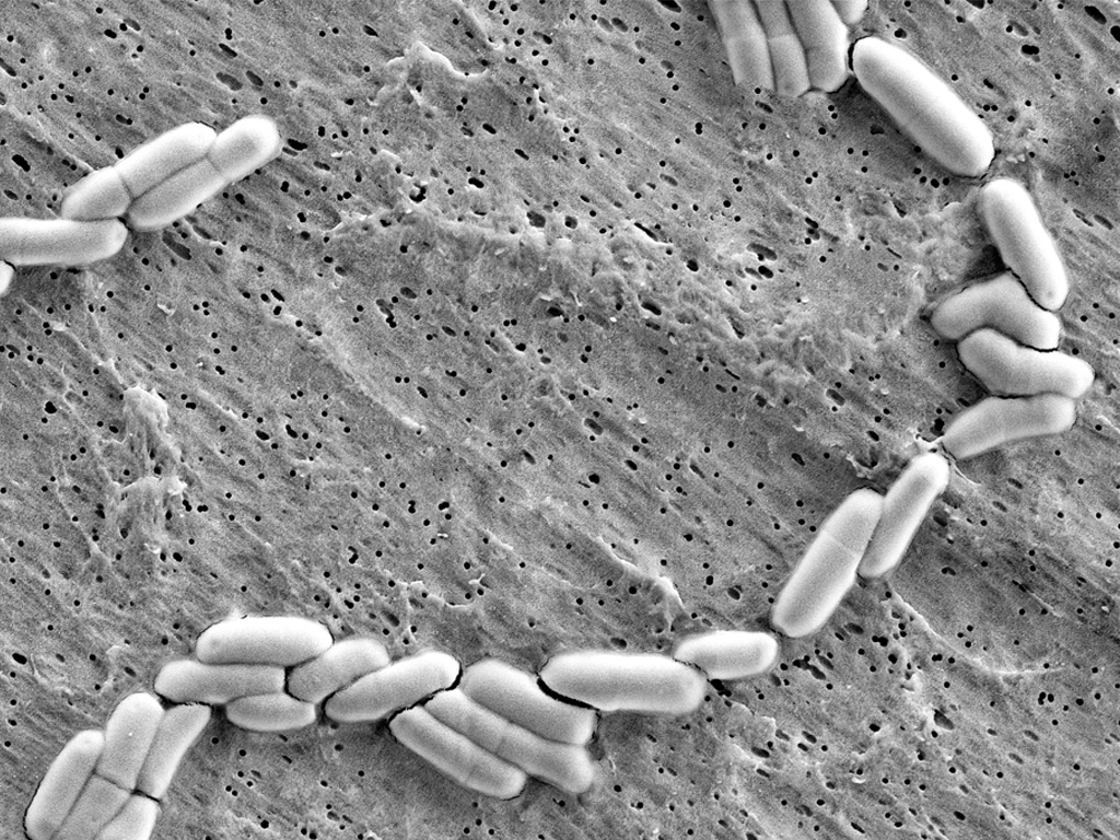  p>动物双歧杆菌(bifidobacterium),是人和许多哺乳动物肠道中的优势