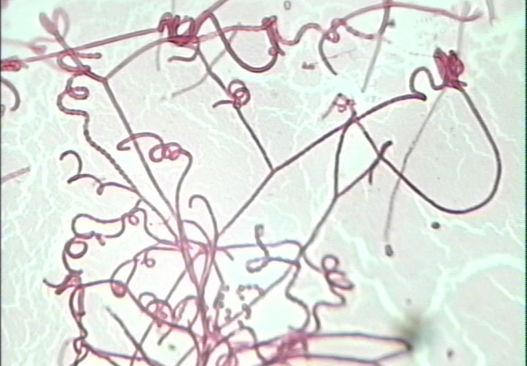  p>放线菌( i>actinomycetes /i>)是原核生物中一类能形成分枝菌丝和   
