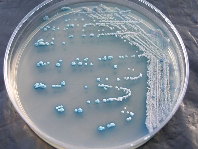  p>酿酒酵母( i>saccharomyces cerevisiae /i>),又称 a href="#"