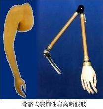 装饰性上肢假肢
